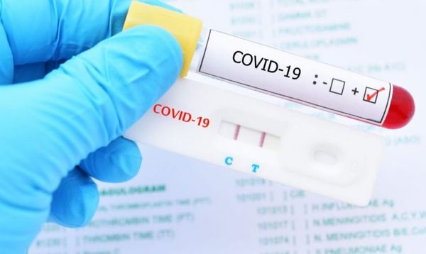 test PCR covid-19 Costa brava